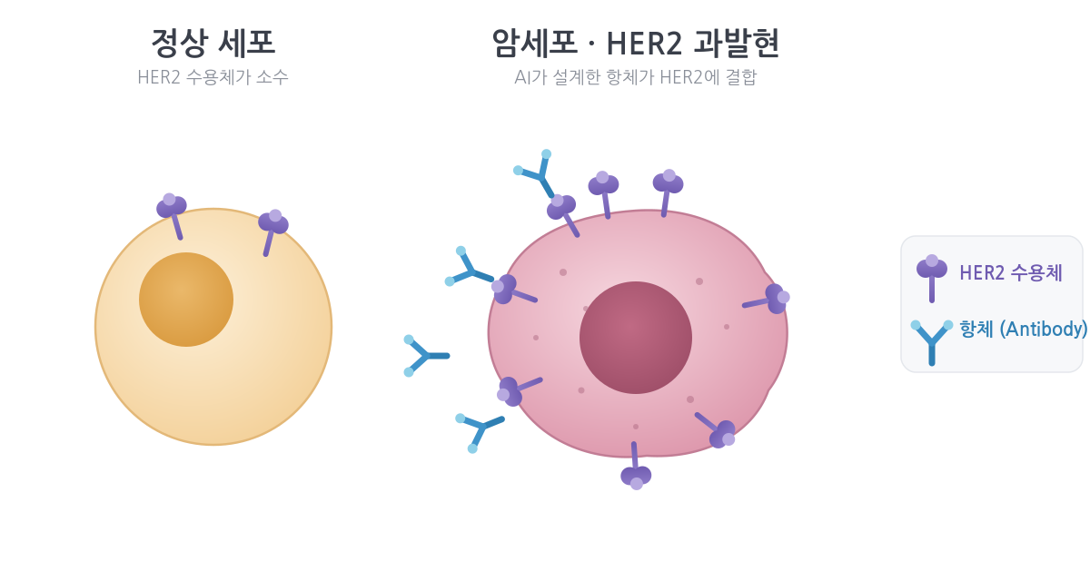 HER2 과발현과 항체 결합 개념도